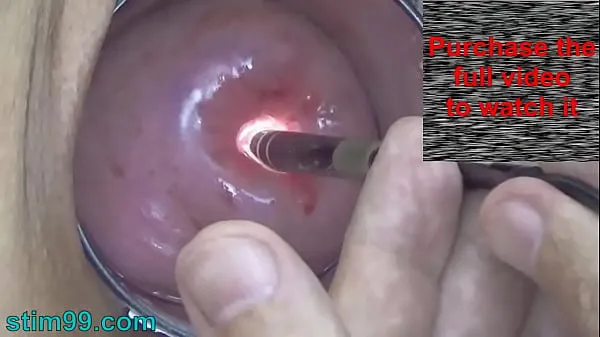 Watch Endoscope Camera inside Cervix Cam into Pussy Uterus top Movies