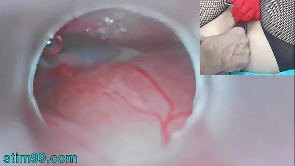 Watch Asian Jav Pregnancy with Semen Injection in Cervix for Impregnation and Endoscopic Cam in Uterus to see inner top Movies